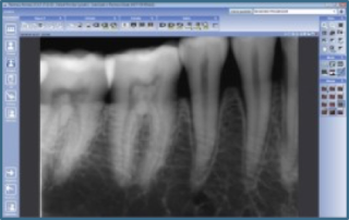 radiografia