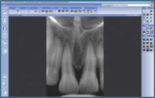 radiografia1
